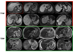 CIRRMRI600+ sample image
